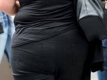 obesity-woman