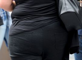 obesity-woman